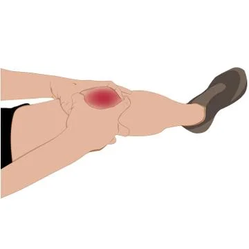 Tendon knee joint problems painful, swelling after from exercise vector illus Illustrazione stock