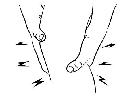 Tendon knee joint problems painful, swelling after from exercise Illustrazione stock