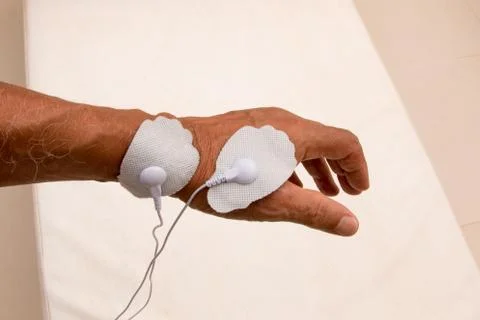TENS Uuit Stock Photos