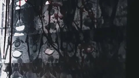 A terrible wall with a lot of X-rays images Stock Footage 76606681