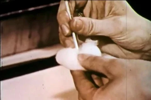 Test are run and red blood cells are looked at under a microscope in the 1960s Stock Footage 99793336