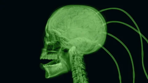 Test on a human skull connected to mystery tubes. Stock-Footage 65606114