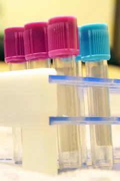 Test Tube Analysis Stock Photos