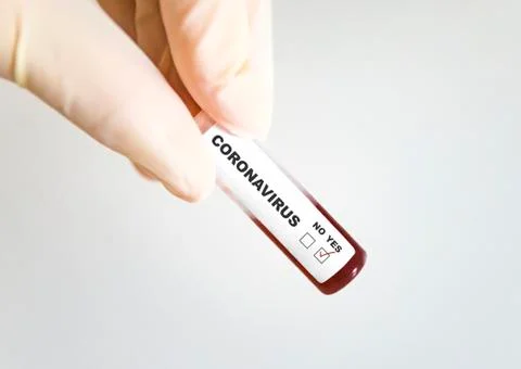 Test tube with blood infected by coronavirus Stock Photos