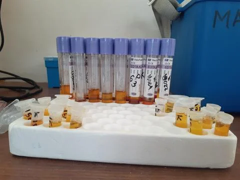 Test tube experiment in lab Stock-Fotos