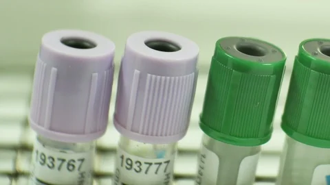 Test tube in laboratory. Stock Footage 108364479