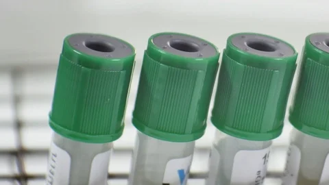 Test tube in laboratory. Stock Footage 108364487