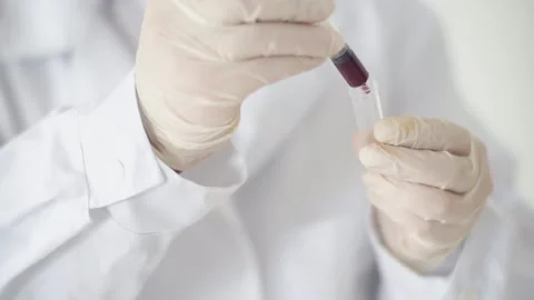 The test tube in which the experimental substance is added in red. The liquid in Stock Footage 131629369