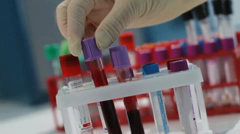 Test tubes with analyses 動画素材 10566157