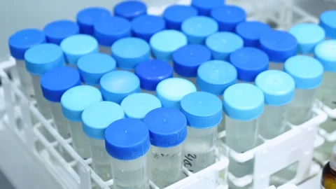 Test tubes for analysis and research. Laboratory. close-up Stock Footage 249601217