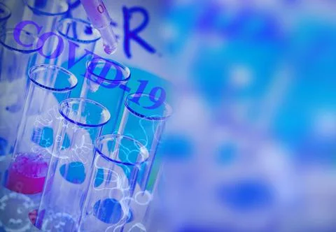 The test tubes and flasks with colored liquid in a laboratory Stock Photos
