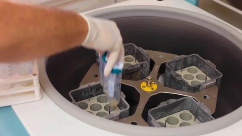 Test tubes are getting inserted into a biochemical analyzer by a lab worker Stock Footage 127286877