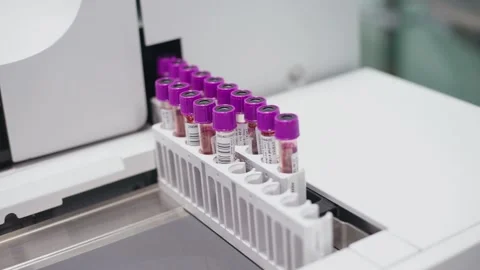 Test tubes are getting inserted into automation blood analyzer	 Stock Footage 133444809