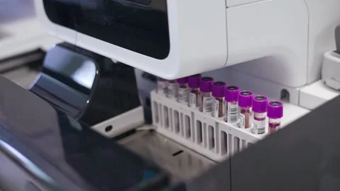 Test tubes are getting inserted into automation blood analyzer	 Stock Footage 133444821