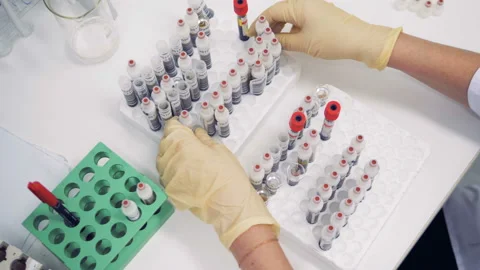 Test tubes are getting pulled out from one palette and inserted into another one Stock Footage 87471670