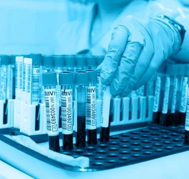 Test tubes with blood for analysis Foto stock