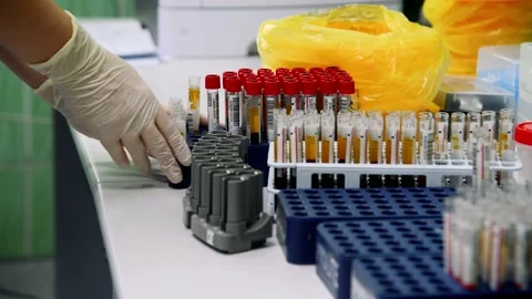 Test tubes with blood. Doctor's hands close up Stock Footage 168984280