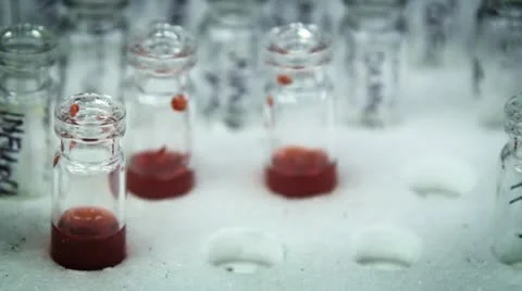 Test-tubes with blood Stock Footage 10584163