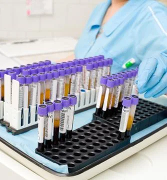 Test tubes with blood Foto stock