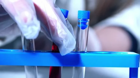 Test tubes with blood sample Stock Footage 306503187