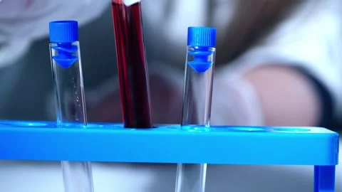 Test tubes with blood sample Video stock 306503312