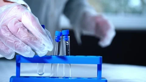 Test tubes with blood sample Stock Footage 308918717