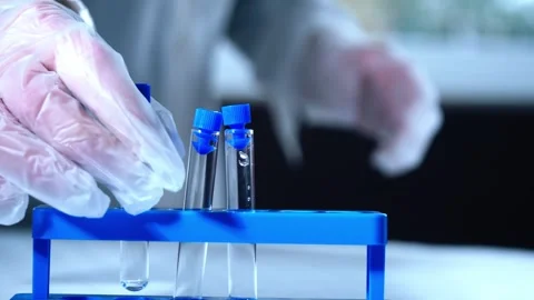 Test tubes with blood sample Stock Footage 310940947