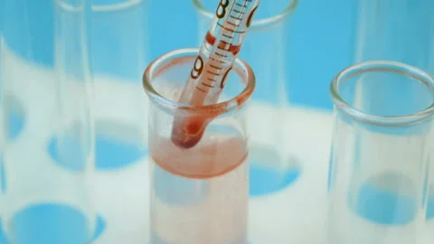 Test tubes with blood sample in laboratory, closeup Stock Footage 133396588