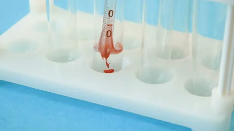 Test tubes with blood sample in laboratory, coronavirus testing, closeup Stock Footage 142961731