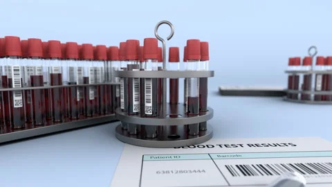Test tubes with blood sample in reserarch lab Stock Footage 128050067