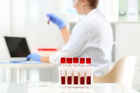 Test tubes with blood samples and scientist working on computer in laboratory Stock Photos