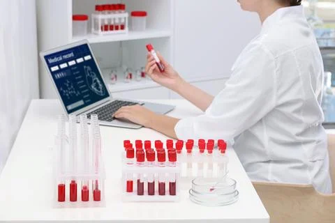 Test tubes with blood samples and scientist working on computer in laboratory Stock Photos