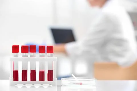 Test tubes with blood samples and scientist working on computer in laboratory Stock Photos