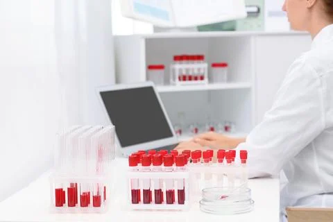 Test tubes with blood samples and scientist working on computer in laboratory Stock Photos