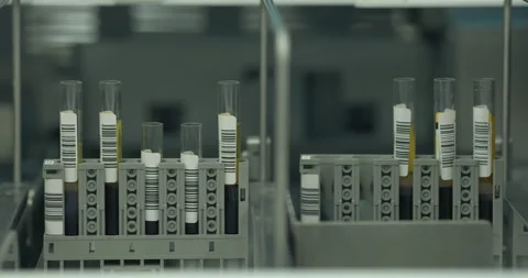 Test tubes with blood samples in automated analyzer. Clinical chemistry Stock Footage 150489898