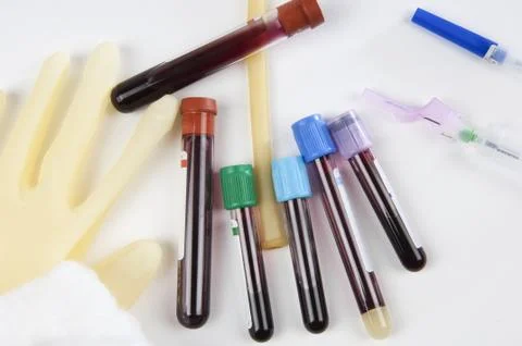 Test tubes with blood samples Stock Photos