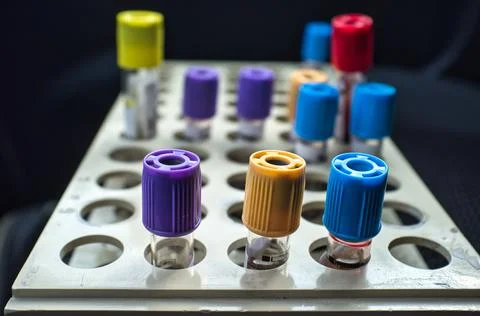Test tubes with blood samples Foto stock