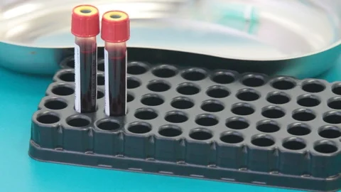 Test tubes with blood on the stand Stock Footage 86270169
