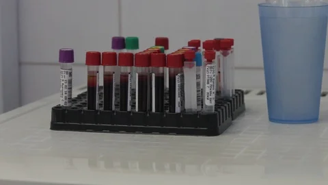 Test tubes with blood on the support Stock Footage 86271116