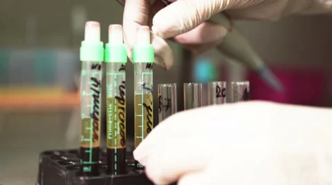 Test-tubes with blood for testing and analysis at modern medical laboratory Stock Footage 59511696