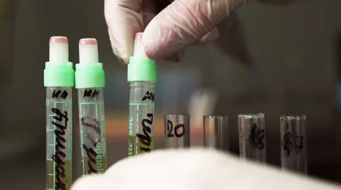 Test-tubes with blood for testing and analysis at modern medical laboratory Stock Footage 59512829