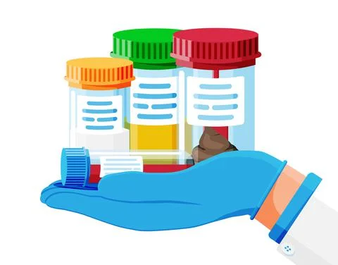 Test Tubes with Caps. Stool, Blood, Urine, Sperm. Stock Illustration