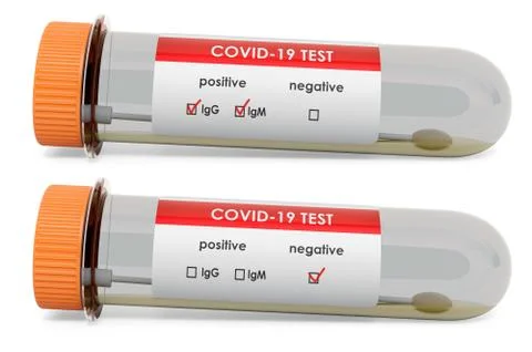 Test tubes with COVID-19 positive and negative nasal swab laboratory tests, 3 イラスト素材