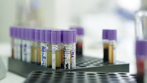 Test tubes filled with samples sit on a rack in a laboratory setting during a Stock Footage 345031391