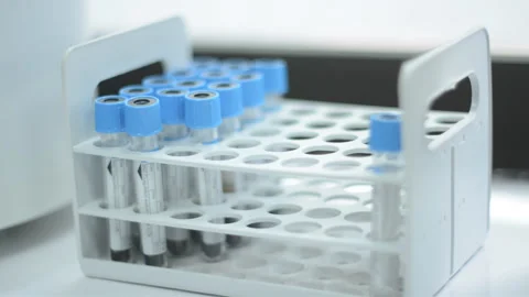 Test tubes Stock Footage 227395138