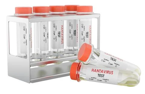 Test Tubes for Hantavirus Testing Arranged in a Metal Rack, 3D Rendering Stock Illustration