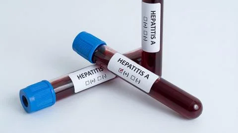 Test tubes with hepatitis a blood sample tubes for medical lab analysis Stock Illustration