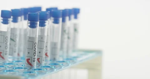 Test tubes in laboratory with COVID testing Stock Footage 127652384