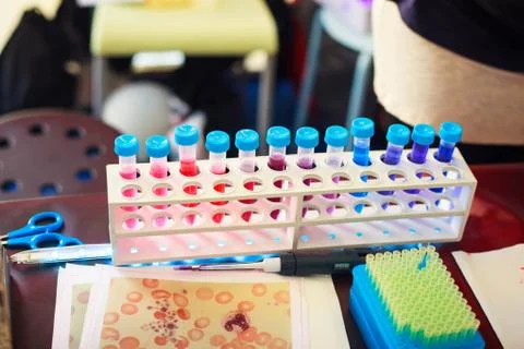 Test tubes Foto stock