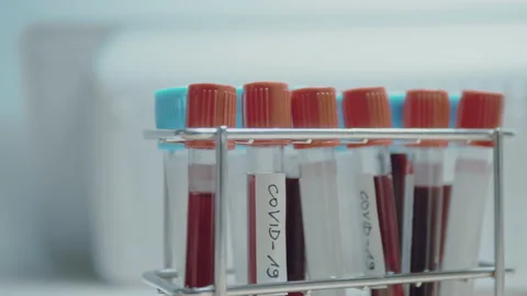 Test tubes with positive and negative results for coronavirus 库存影片 169245516